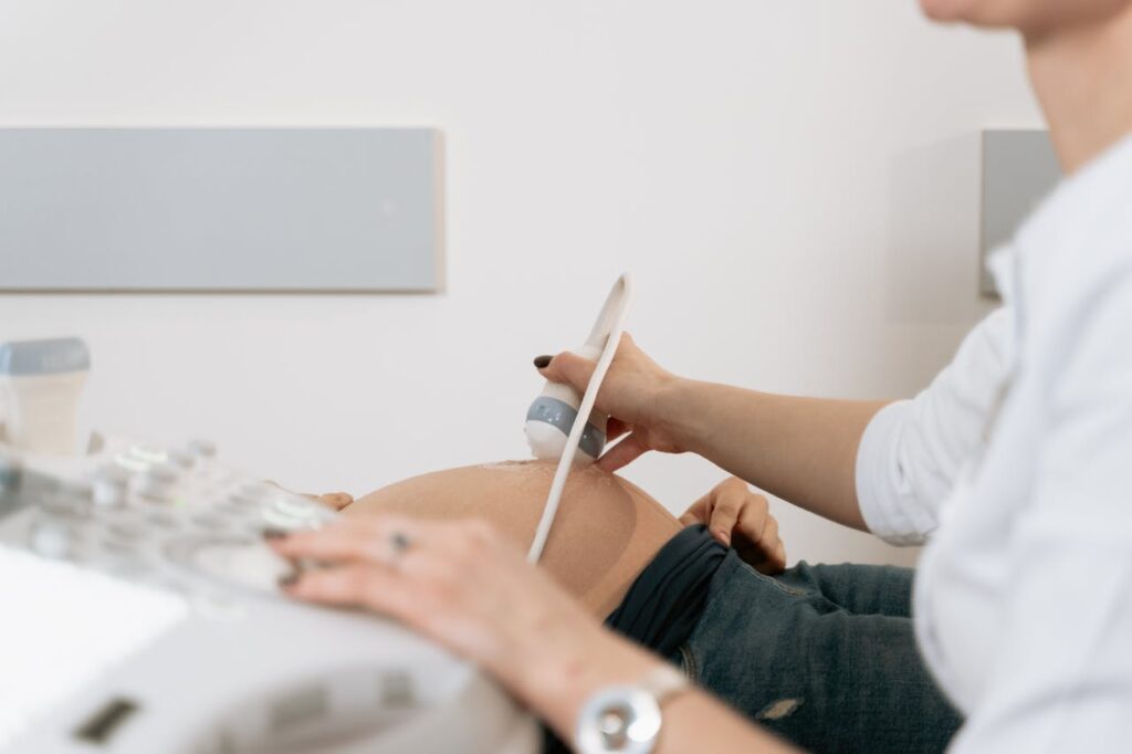 omocisteina alta gravidanza diabete gestazionale